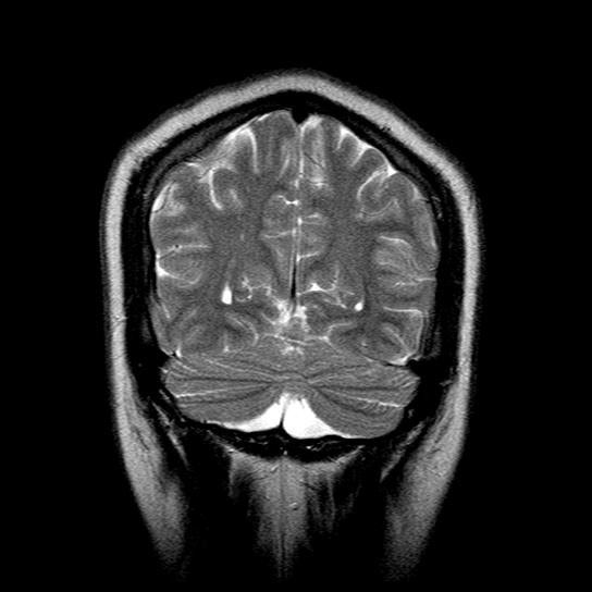 mri-scan-animation.gif
